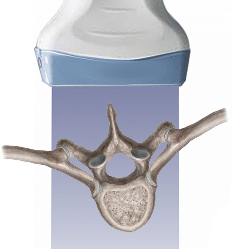 Spine-with-ultrasound-800×860